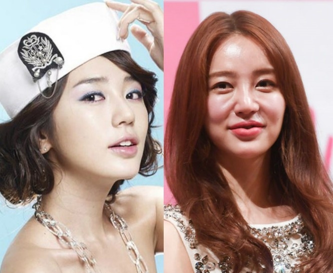 Yoon Eun Hye và mỹ nữ Hàn nghiện sửa sang nhan sắc